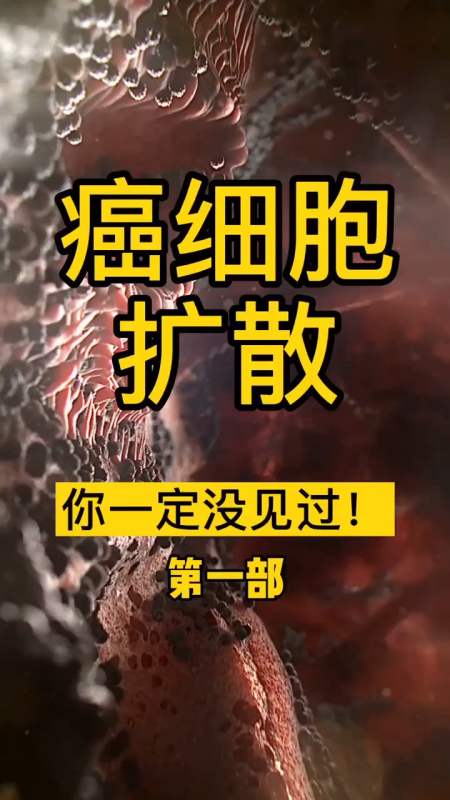 显微镜世界#癌细胞扩散你见过吗第一部-度小视