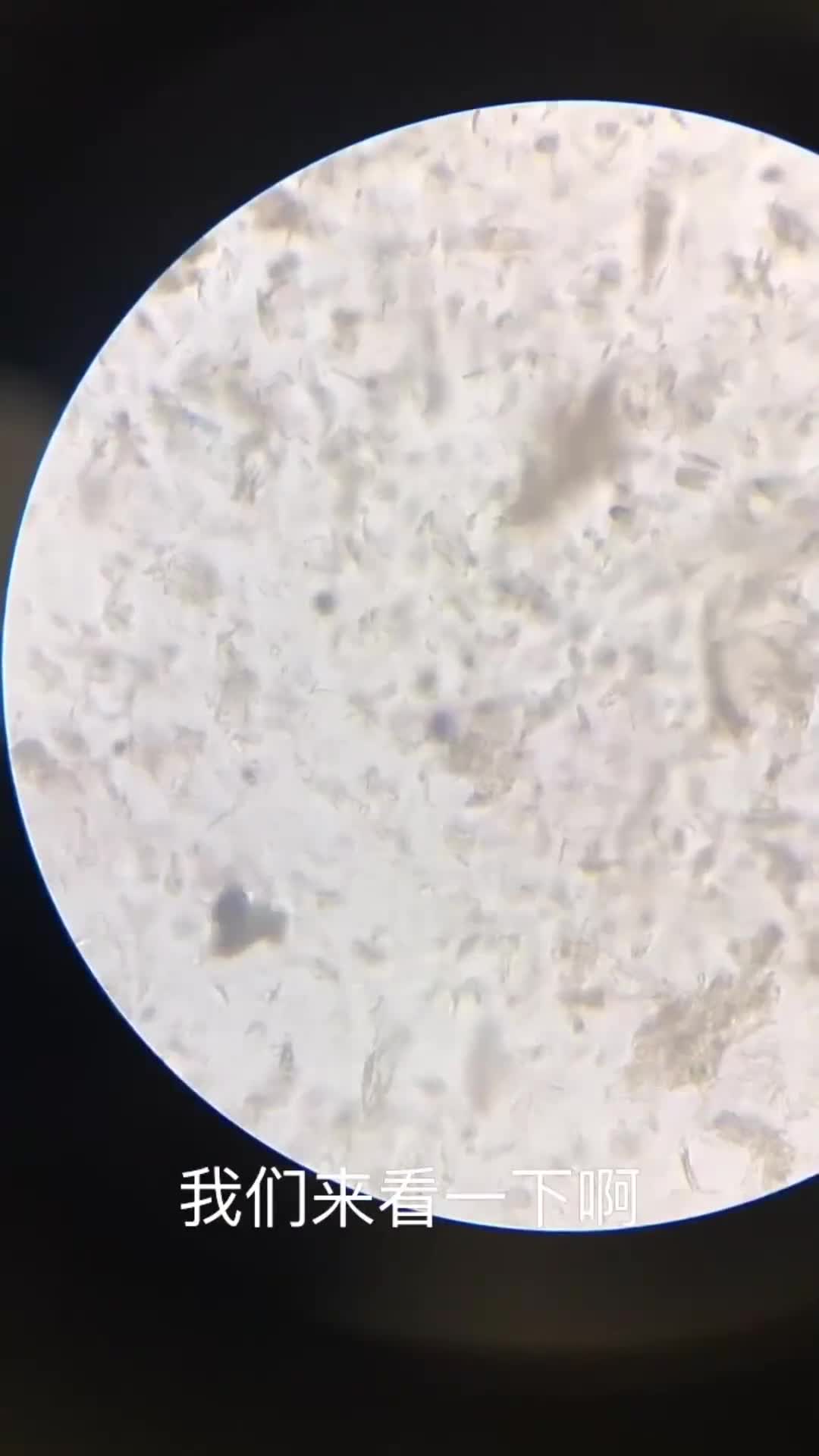 人类皮肤上的螨虫在显微镜下放大竟然是这个样子看起来真恶心