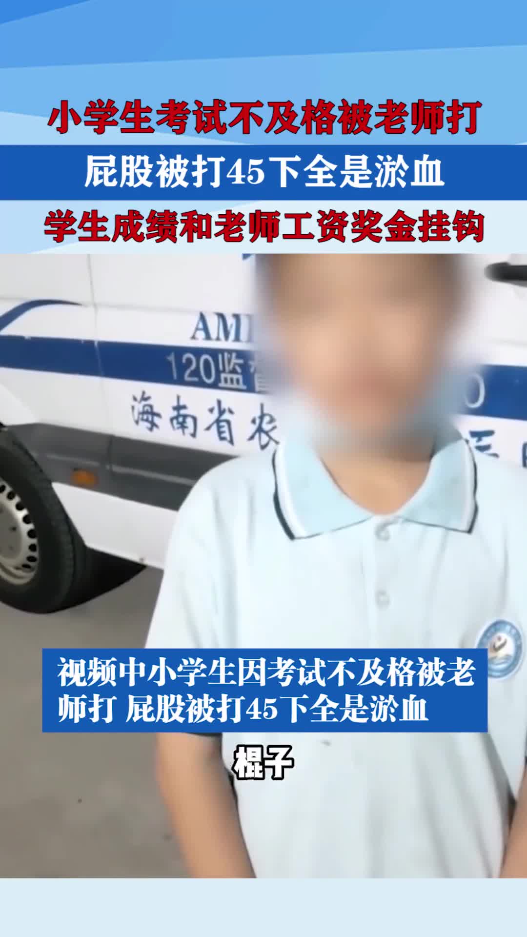 孩子因考试考不及格被打屁股上都是伤网友成绩和奖金工资是挂钩的