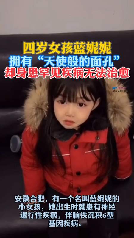 100条评论 0/100 回复 wuli清22天前 歌舞伎面谱综合征(洋娃娃综合征)