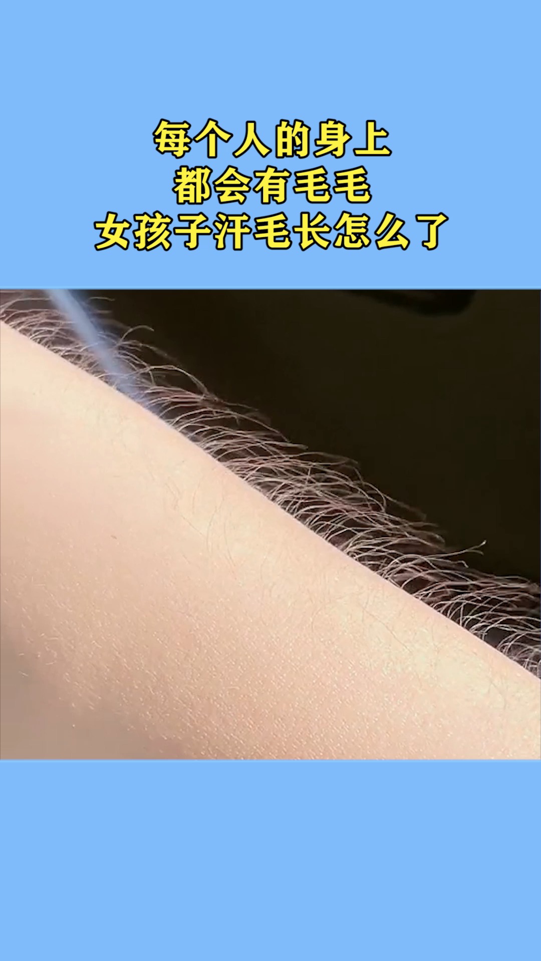 每个人的身上,都会有毛毛,女孩子汗毛长怎么了!