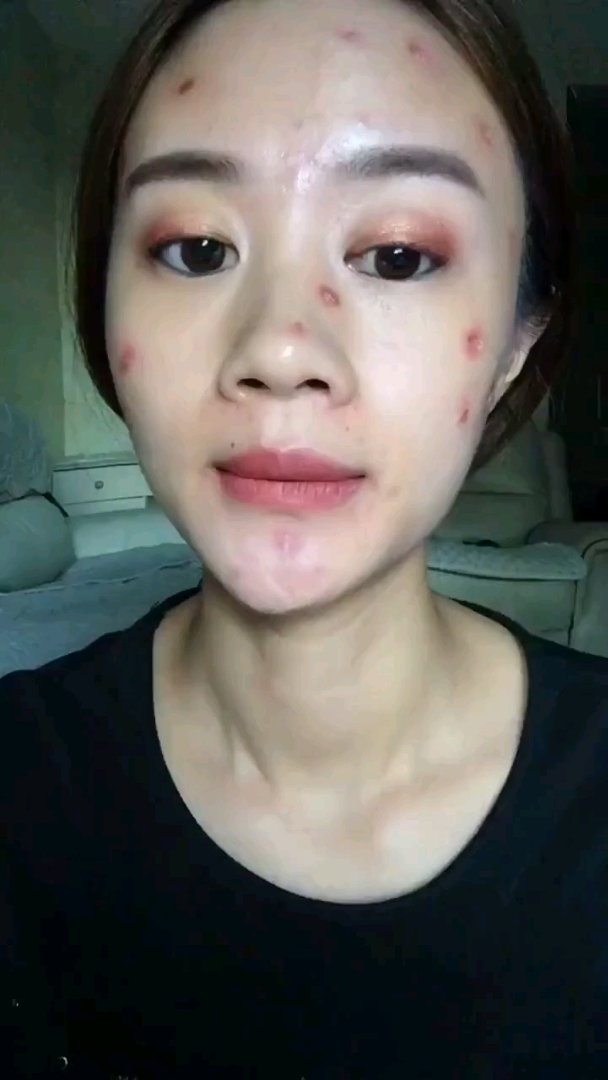 脸上瑕疵一折,全部掉