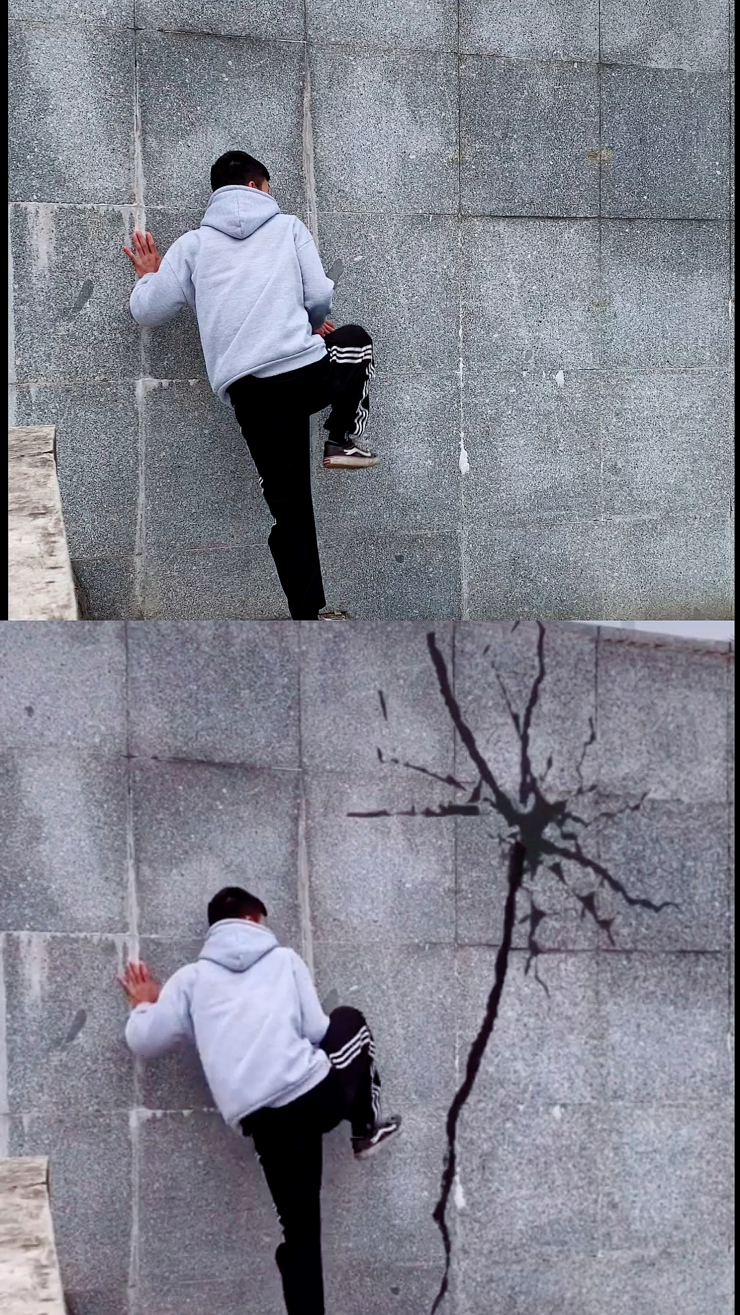 穿墙术前后对比