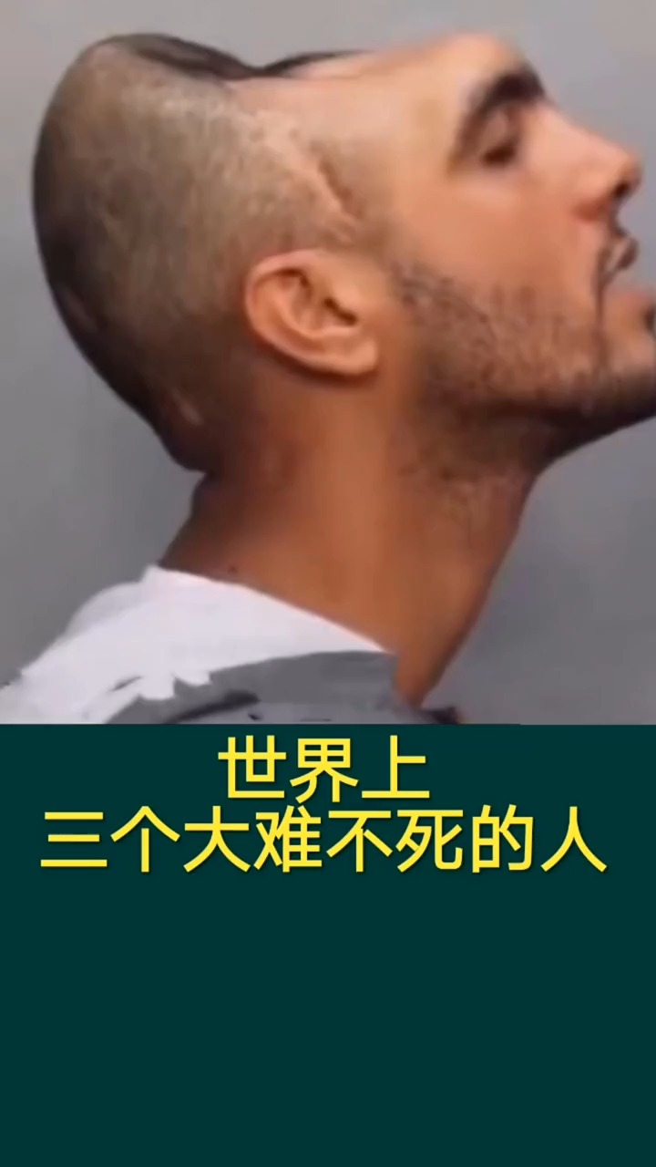 奇闻趣事抢先看世界上三个大难不死的人
