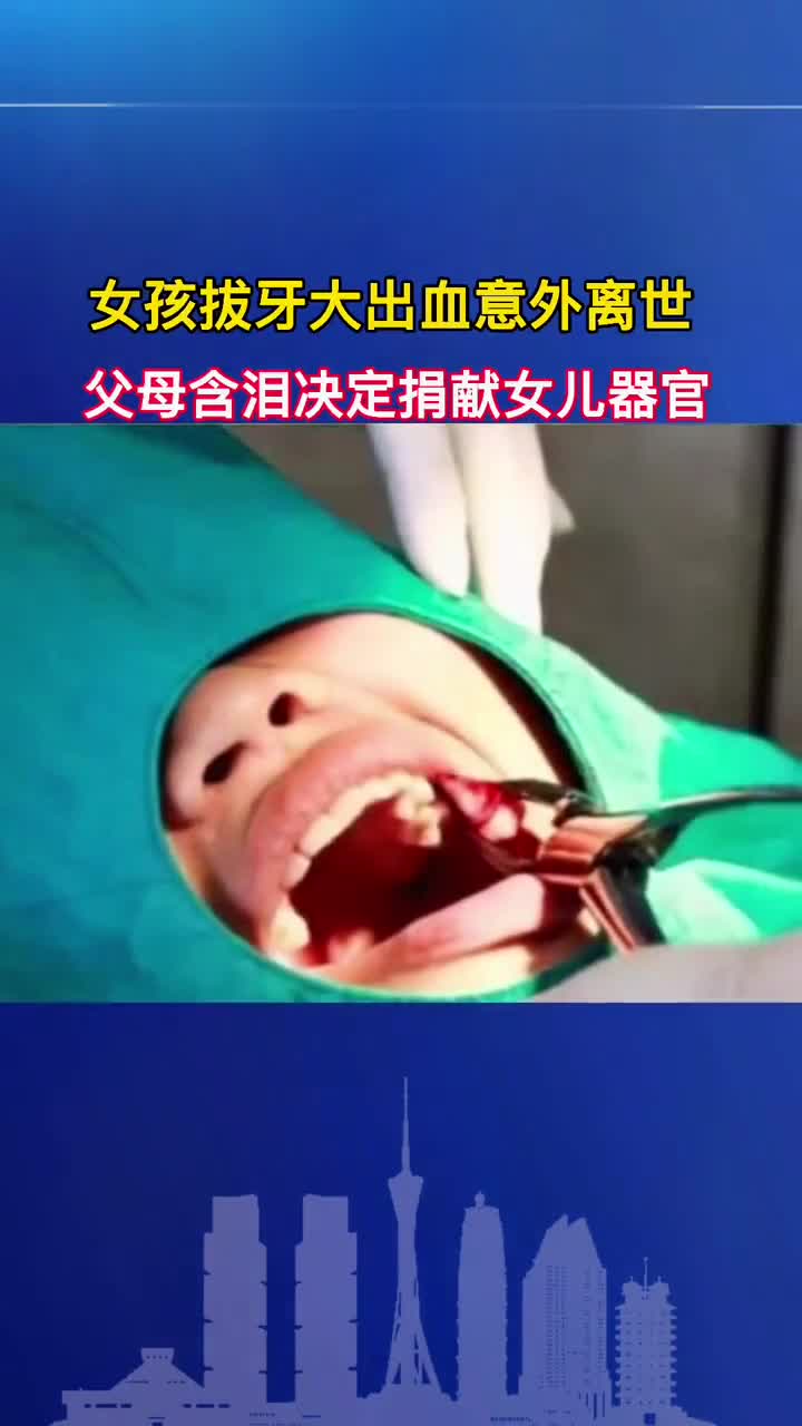 广西5岁半的女孩因牙齿松动去医院拔牙后,流血不止造成脑死亡
