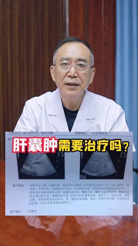 全民涨知识肝囊肿需要治疗吗