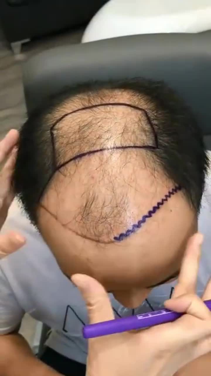 我要上热门#大叔败顶,想让托尼老师剪一个头发茂密的发型,这不难稳怂