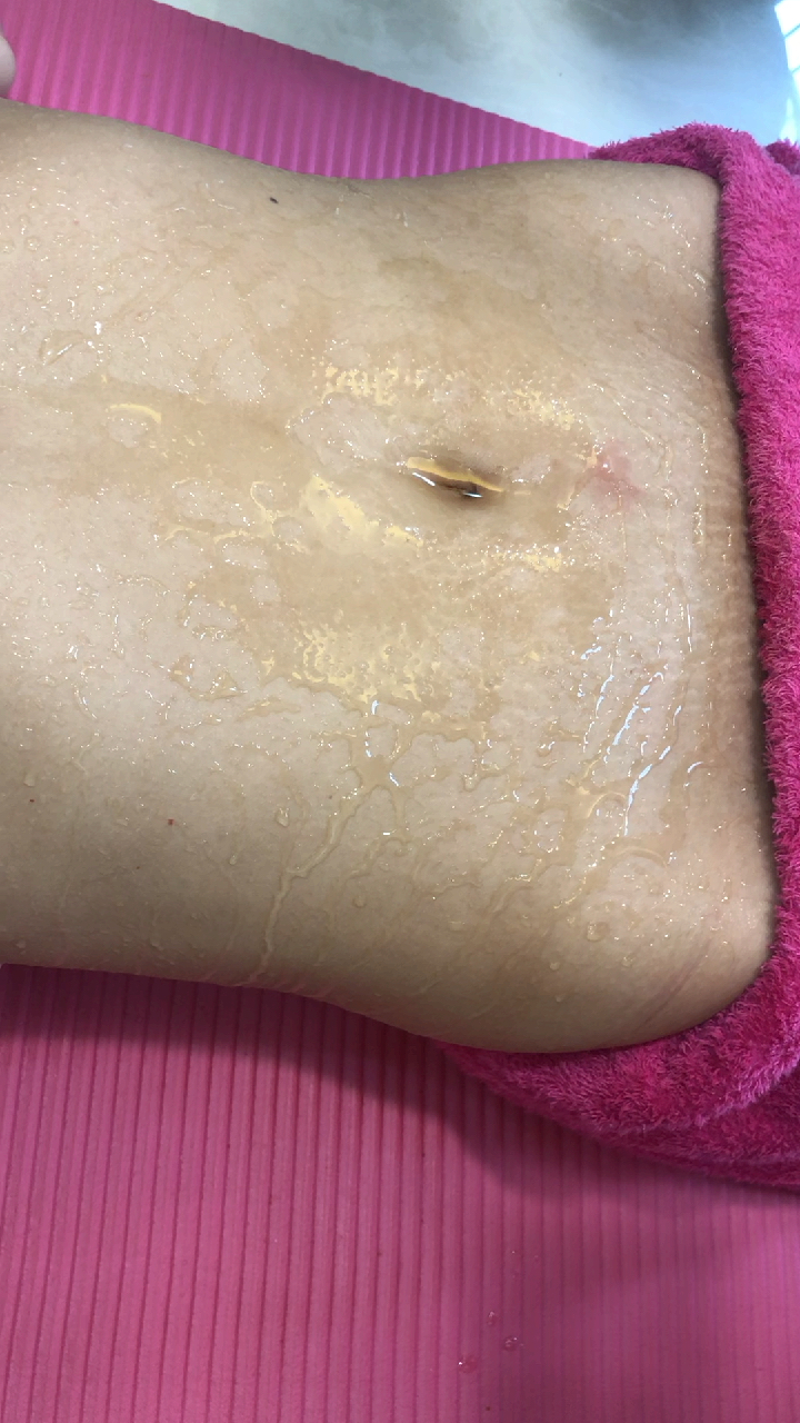 生完孩子肚皮松弛,老公嫌弃,和闺蜜一起排油减脂,她瘦了48我瘦了51斤