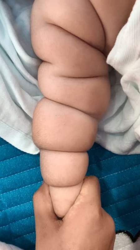 看看我们家宝宝的汗毛这么重想想都气人医院也检查身体啥都正常现在