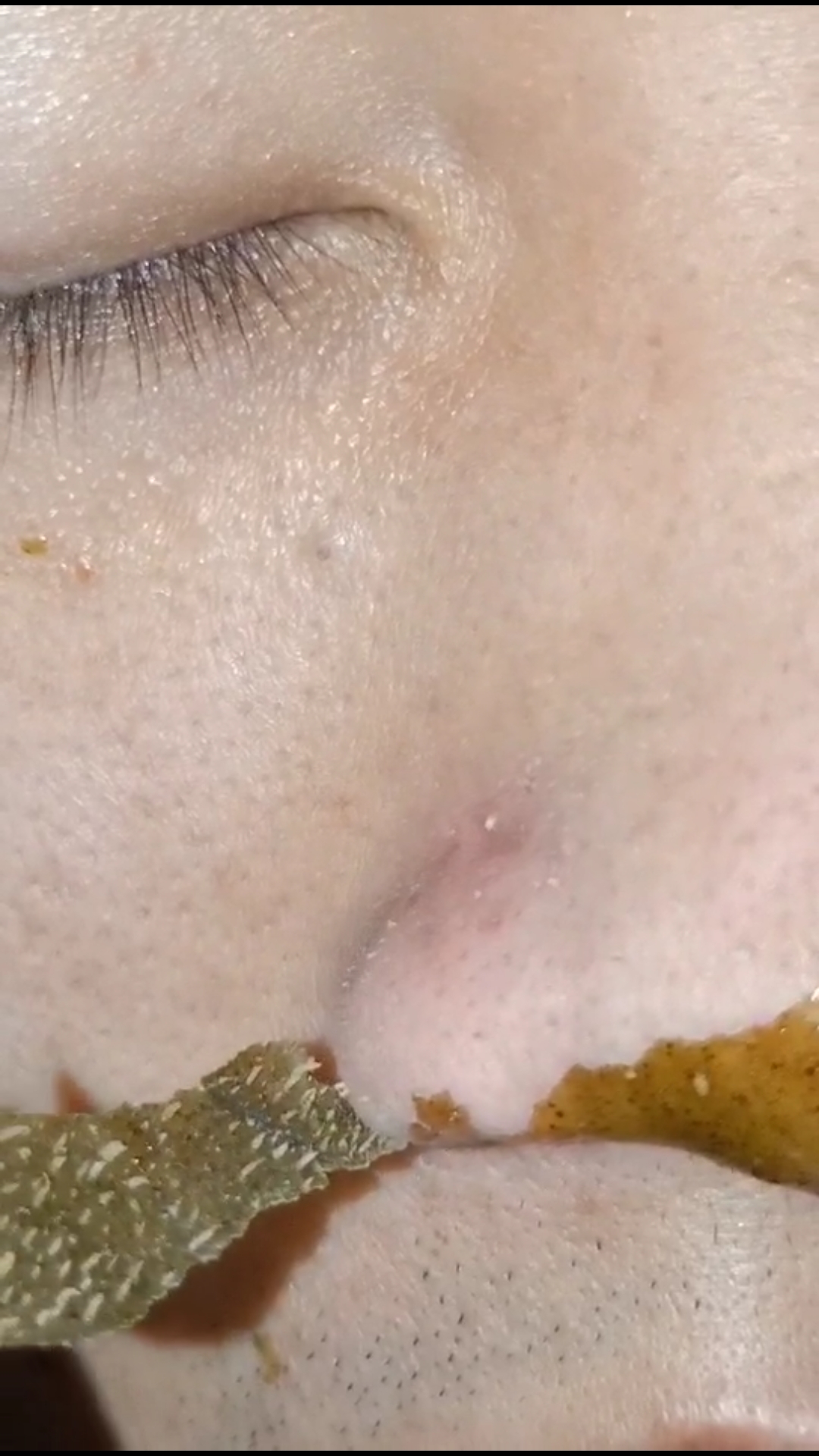 我有一个逗比朋友#鼻子坏了