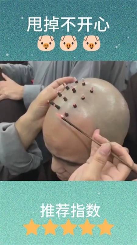 出家人头上的戒疤原来是这样烧上去的-度小视