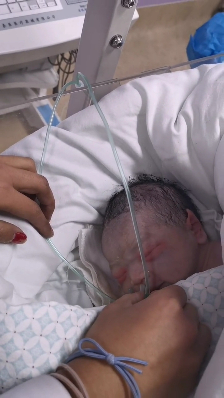 还没到医院,结果生到了来医院的路上,宝宝严重缺氧,一样一切平安孕