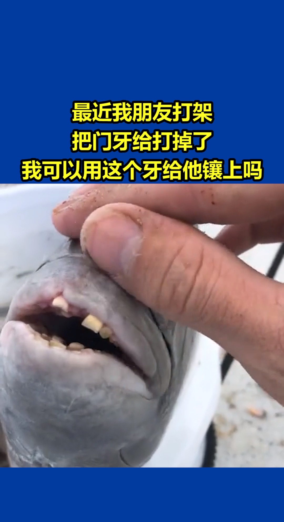 我要上热门最近我朋友打架把门牙给打掉了我可以用这个牙给他镶上吗