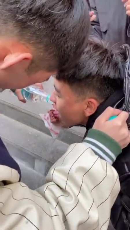 在夹缝中求生存,室友吃雪糕,舌头被粘住了!