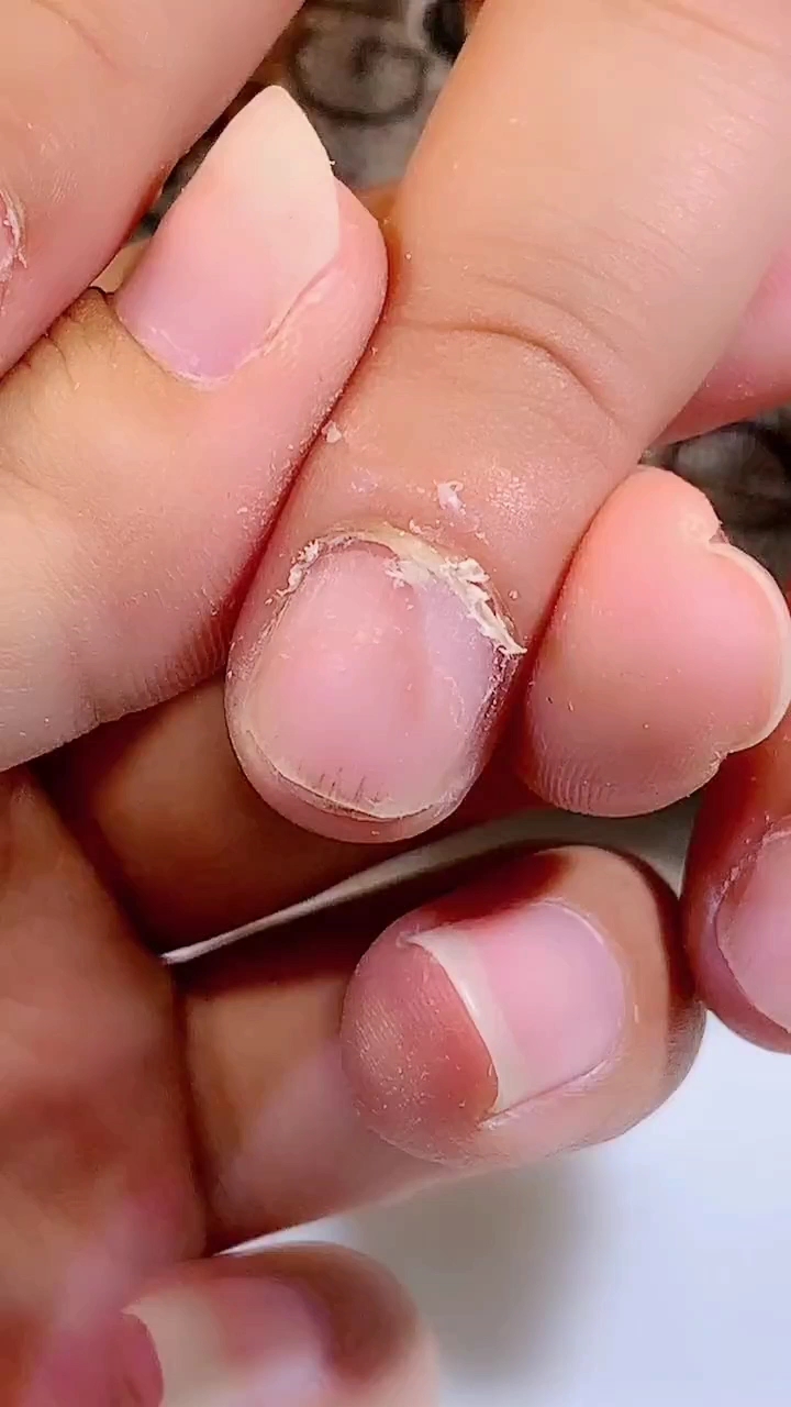 老公出差回来手指干成这样了,辛苦了我给你修修