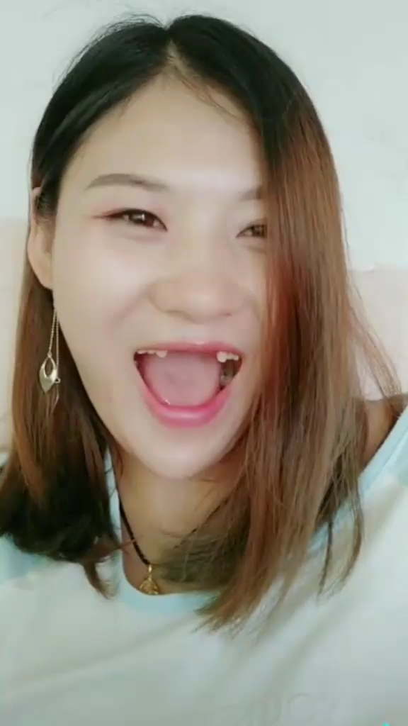 又都猜,牙应该是笑掉了