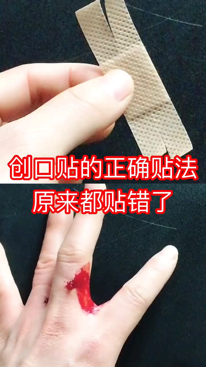 生活小妙招#受伤了,这样贴创口贴,更牢固