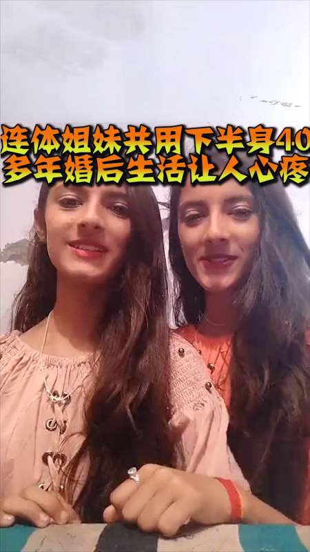 奇趣#连体姐妹共用下半身40多年,婚后生活让人心疼