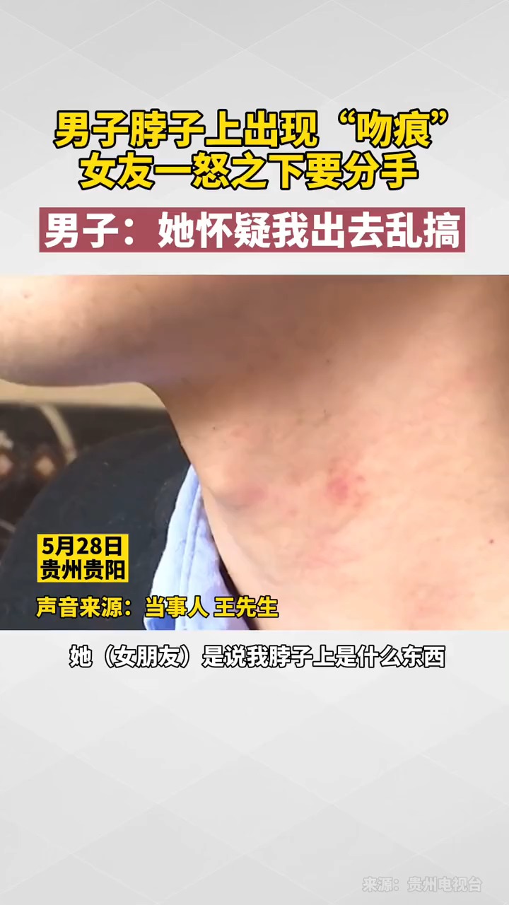 男子脖子上出现吻痕,女友一怒之下要分手