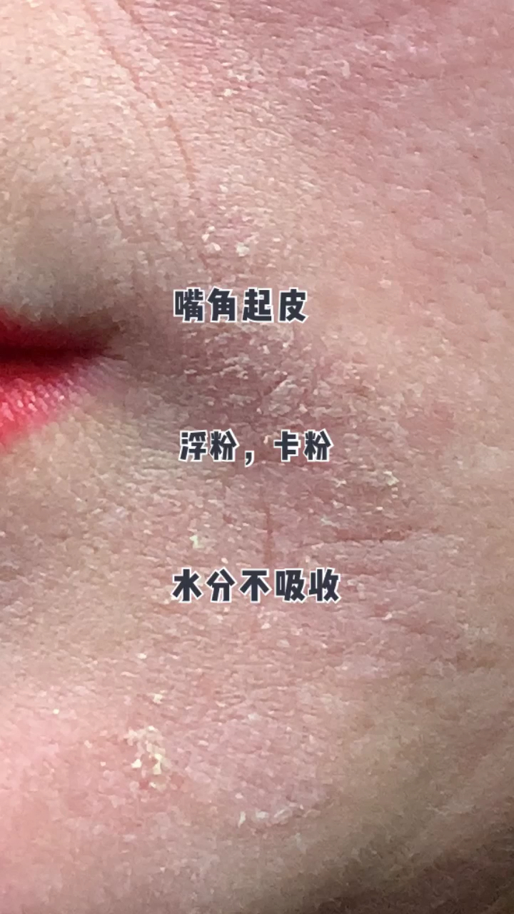 加油武汉#浮粉 卡粉,起皮帮你解决这样皮肤问题!