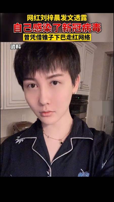 刘梓晨曾凭借尖到不行的锥子下巴走红网络.-全民小视频