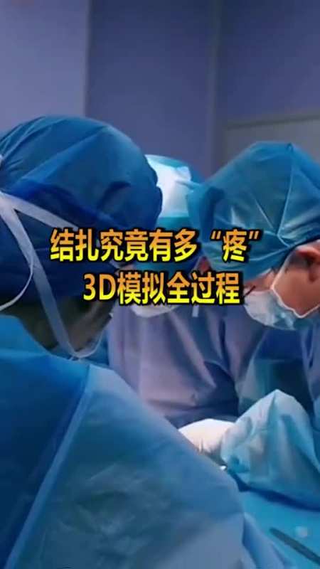 "结扎"到底有多"疼"呢?