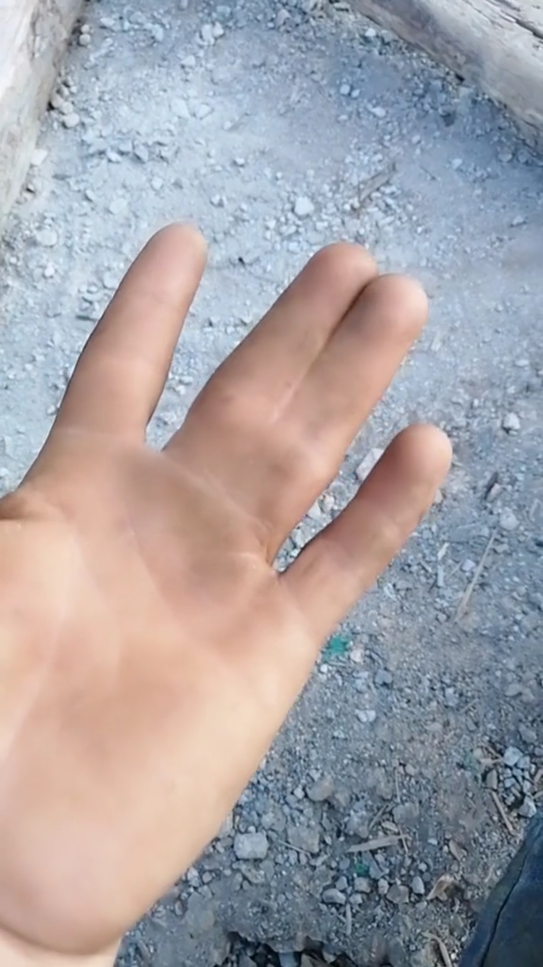 太奇怪了,第一次见到这样的手指.大家说说谁说为什么成这样?