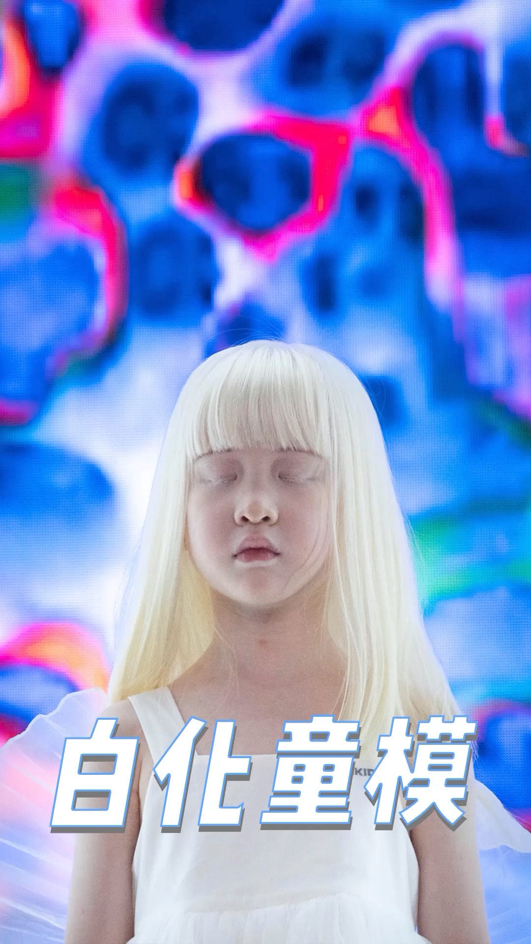 白化病小天使#墨镜一戴,白化小女孩如何"奇迹"般成为普通人?