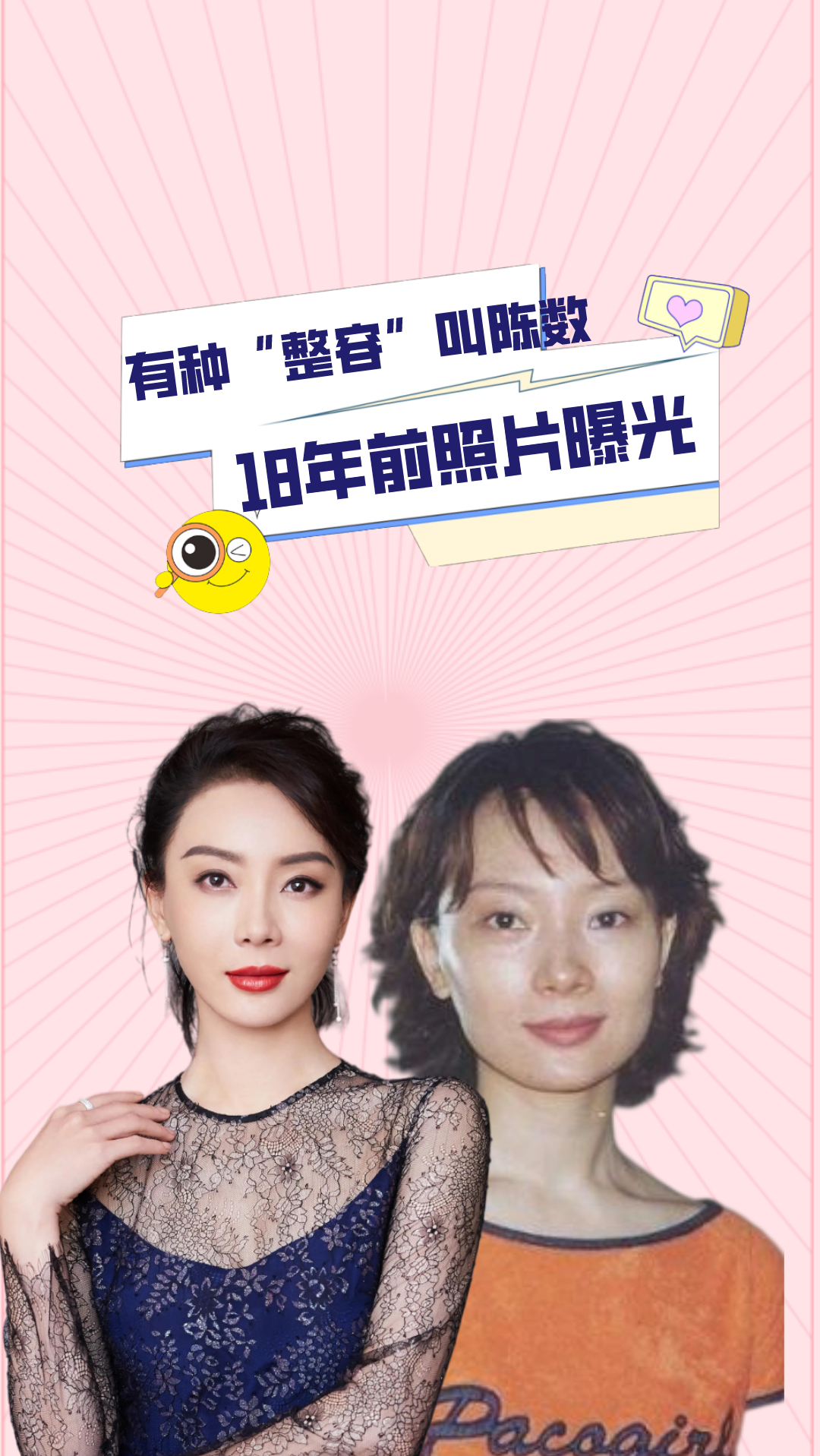 有种整容叫陈数18年前照片意外曝光网友经历了啥