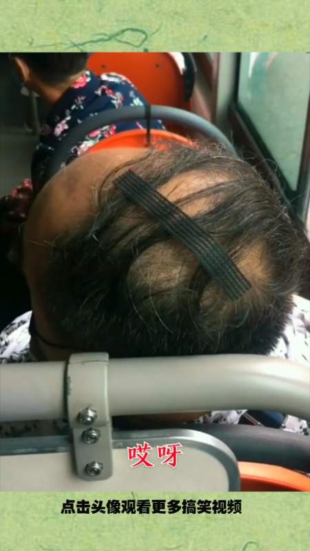 搞笑配音#只要胶带贴的好,头发少的没烦恼!-全民小视频