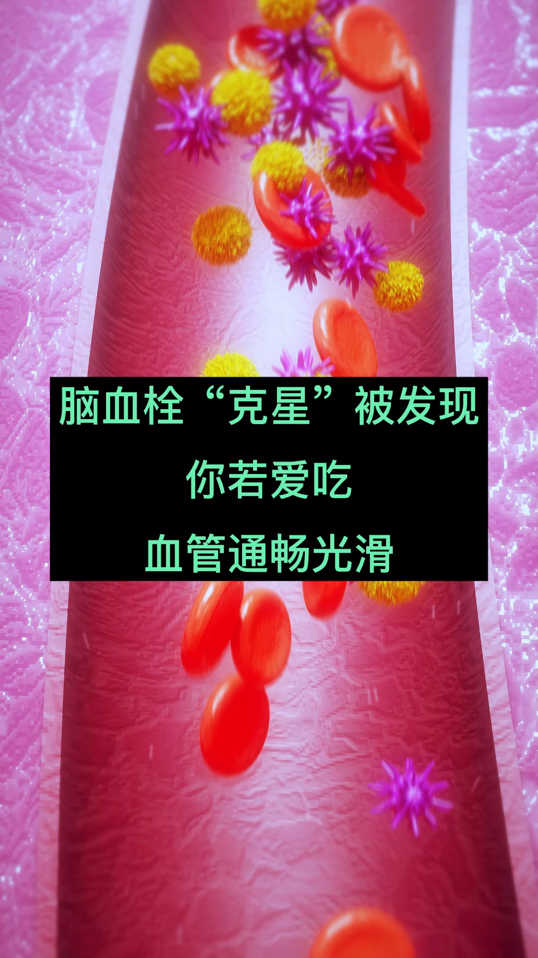 脑血栓克星被发现你若爱吃血管通畅光滑
