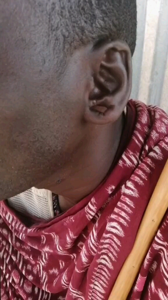 非洲男人从婴儿就开始打的耳洞,到现在变的好大了