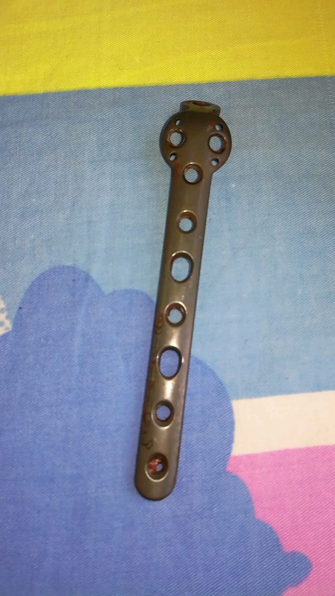 这个花2万多的钢板从胳膊里取出来了