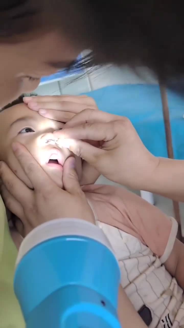 我要上热门#鼻腔塞进异物轻松取出方法