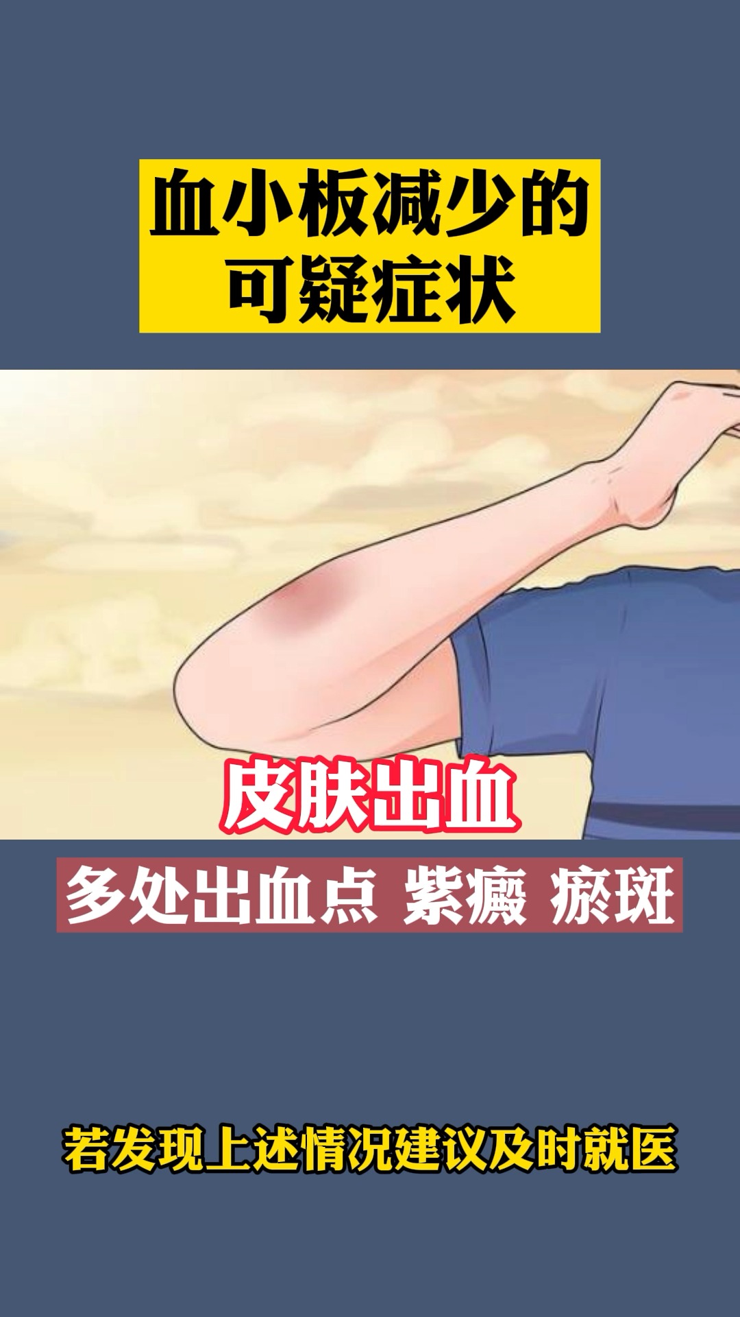 血小板减少有什么可疑症状