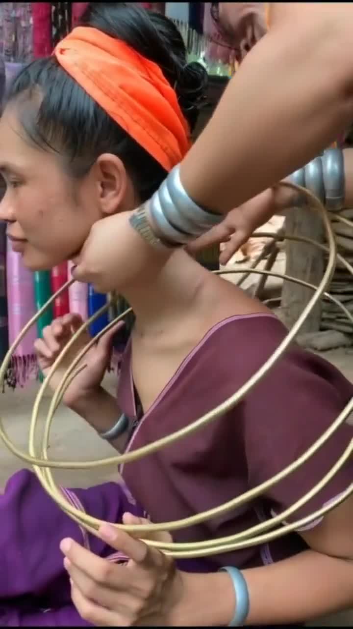 长颈族人圈拿掉后原来是这样的真是长见识了