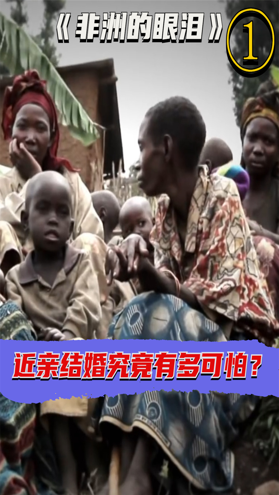 非洲近亲结婚的危害有多大三个孩子两个有遗传疾病