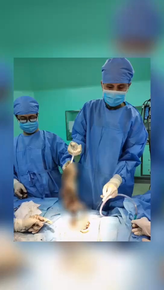 10岁女孩胃里全是头发,只因为小时候的这个习惯!#异食癖-度小视