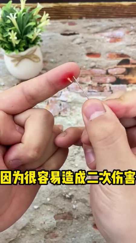 手指扎刺了千万不要用针去挑,容易沾染上细菌!