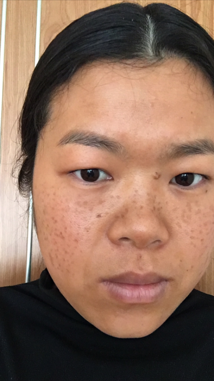 每天涂涂抹抹,短短两个月的时间,终于告别了斑点,暗黄,细纹,皮肤也