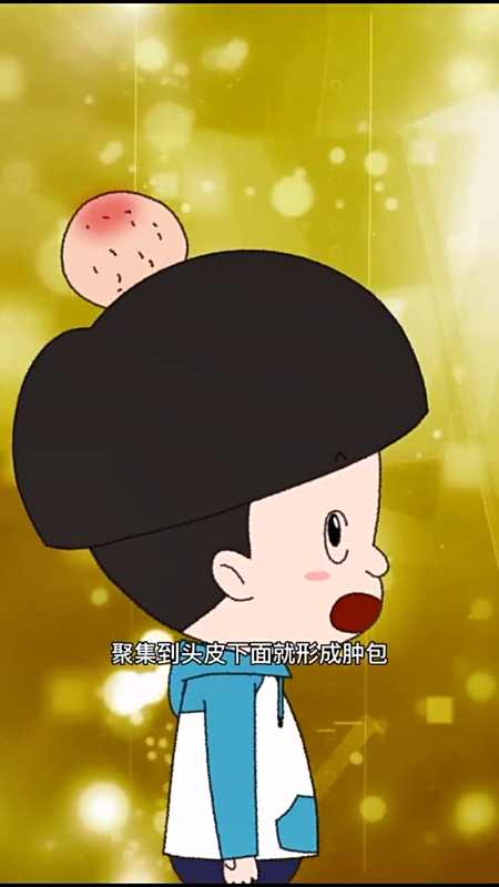 为什么撞到头会起包这个问题哪个大佬能解答一下呢