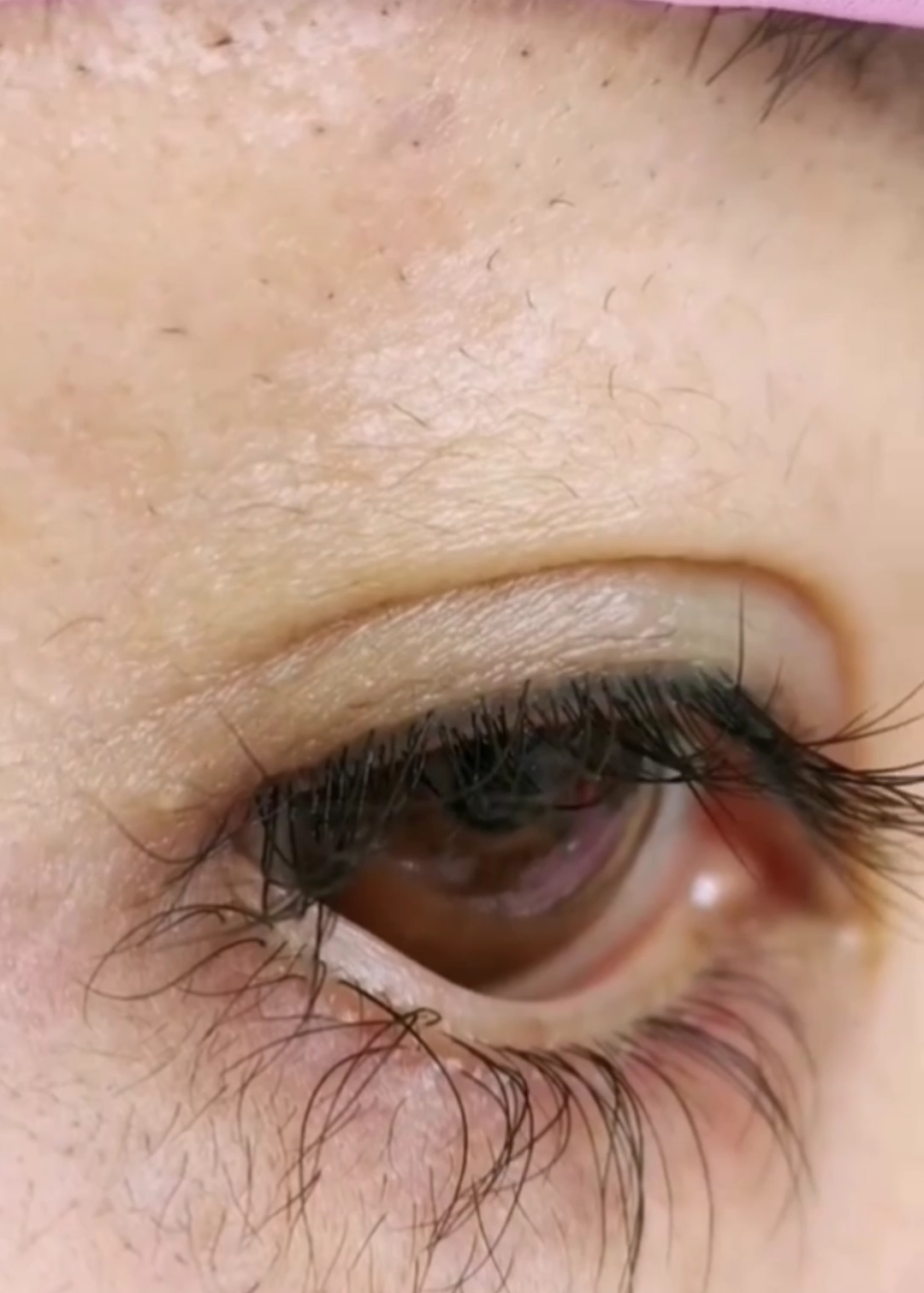 自体生长长睫毛#眼角就用几次,竟然涨了好多毛毛!真的图那涨那啊