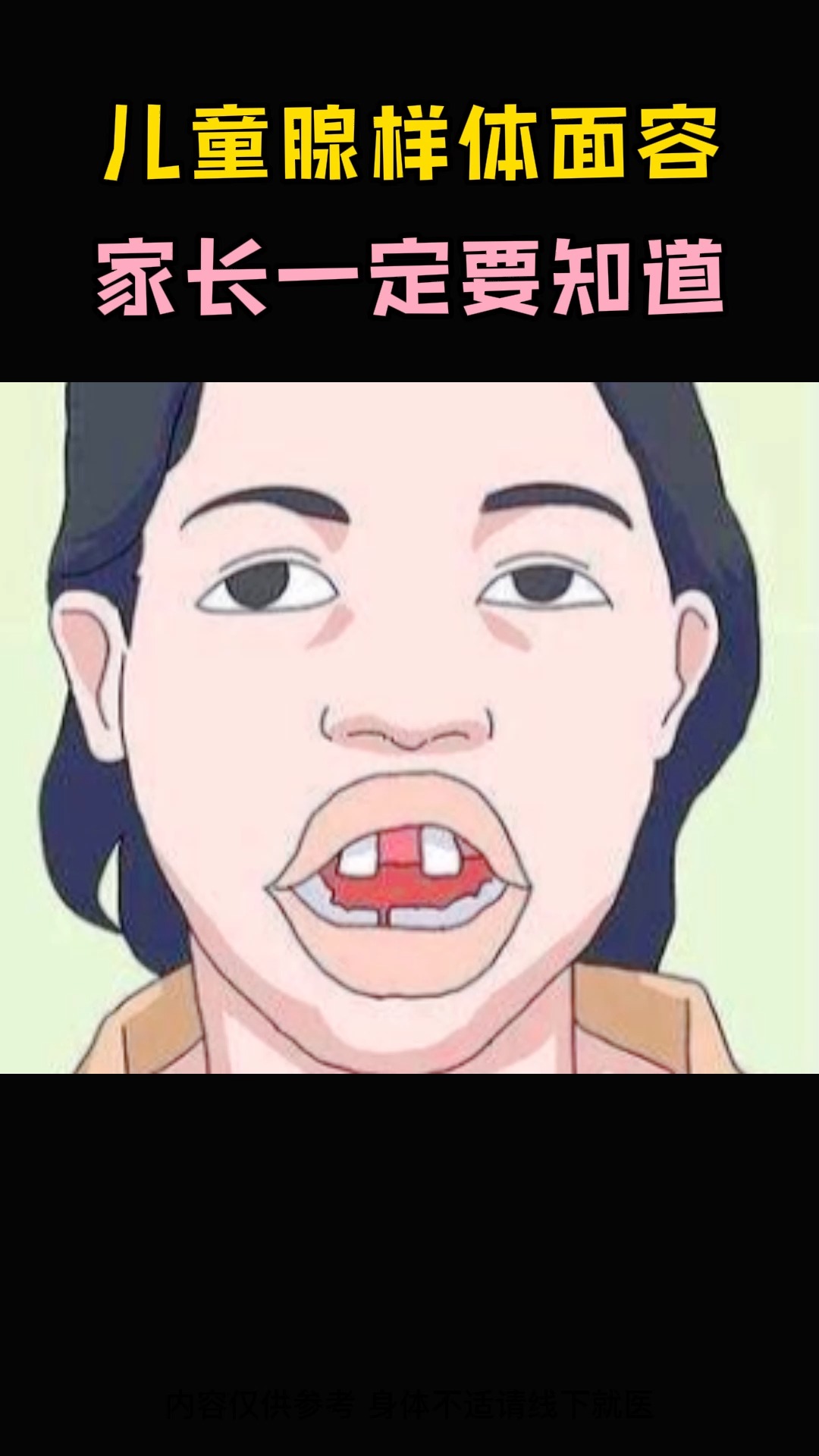 医学小常识儿童腺样体面容家长一定要知道