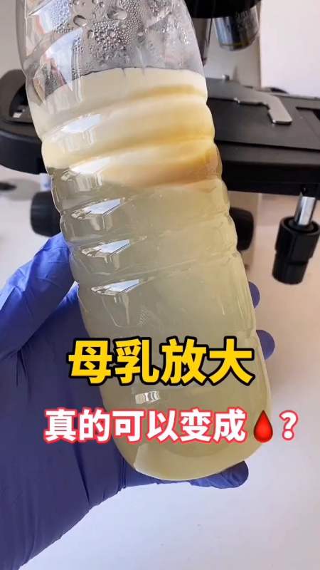 沉淀后的母乳放大,里面到底有水吗?