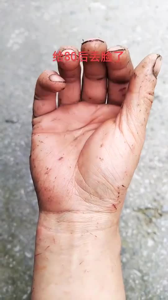 我晒一下自己养的手只有满手的伤痕洗不掉的老茧给80后丢脸了