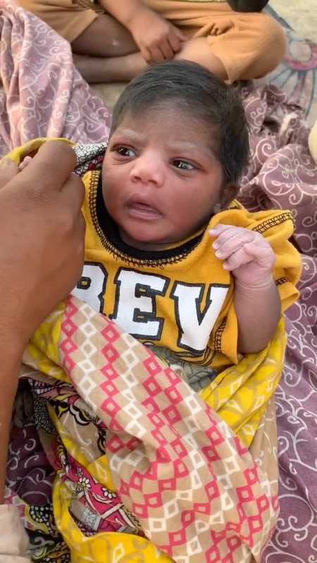 刚出生的巴基斯坦宝宝,因为近亲结婚的原因,导致手指比别人多了一根