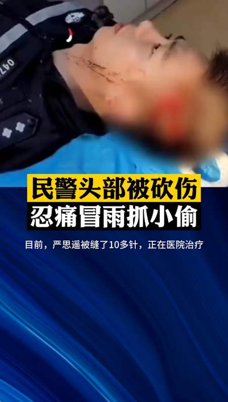 心痛#民警抓捕小偷时头部被砍伤,忍痛冒雨抓