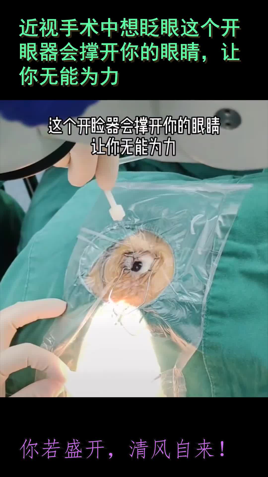 近视手术中想眨眼这个开眼器会撑开你的眼睛,让你无能为力