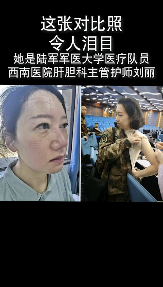 致敬白衣天使#这张对比照,令人泪目!-度小视