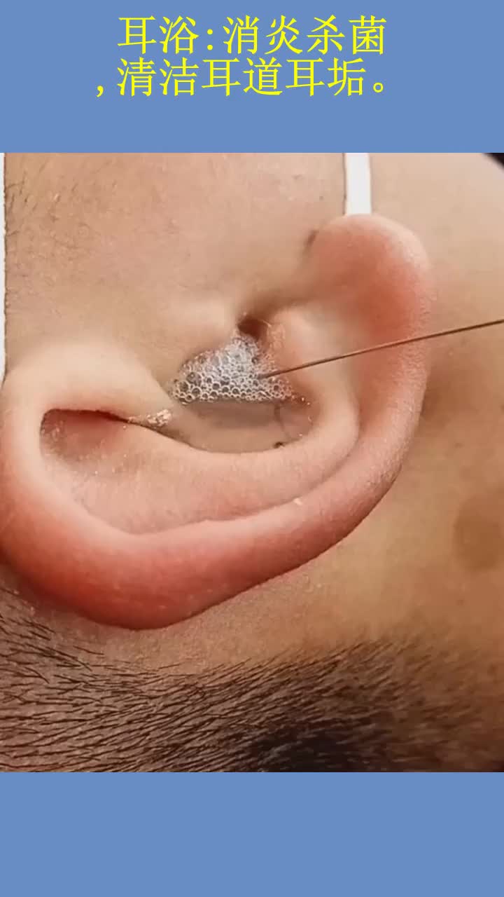 耳浴:消炎杀菌,清洁耳道耳垢.